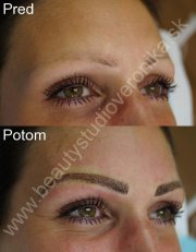 Permanentný make-up obočia čiarkovanou metódou