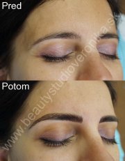 Permanentný make-up obočia čiarkovanou metódou